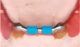 RHEIN 83 OT BAR MULTIUSE CLIP B IN PROMO - immagine 3